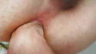 &Ouml;kl&ouml;z&eacute;s